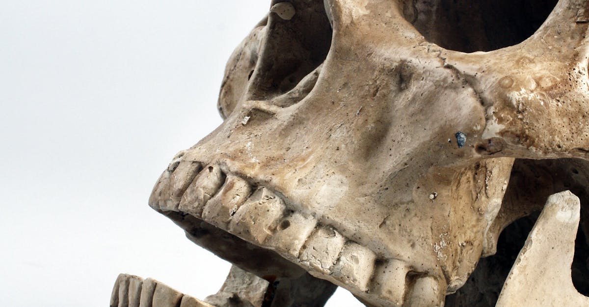 Common Signs of Complications During the Recovery Period for Dental Implants