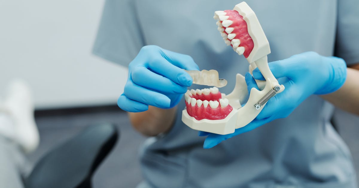 Comparing General Anaesthesia and Local Anaesthesia for Implants