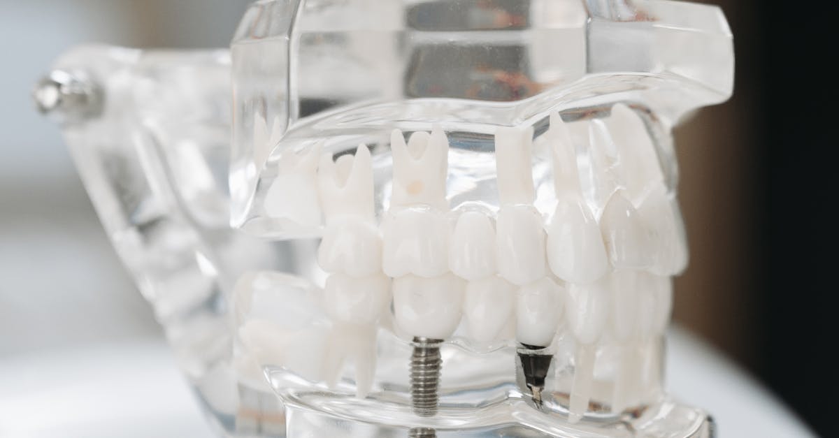 Diagnostic Imaging Techniques for Effective Implant Planning