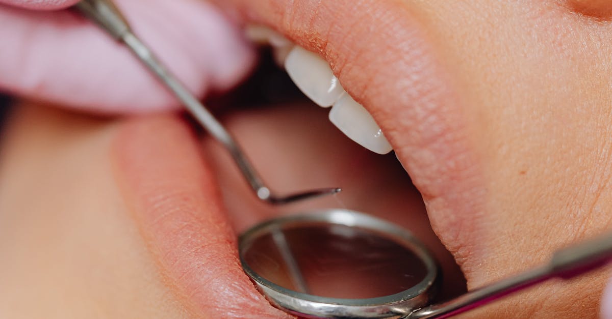 Essential Tips for a Smooth Recovery After Dental Implant Surgery