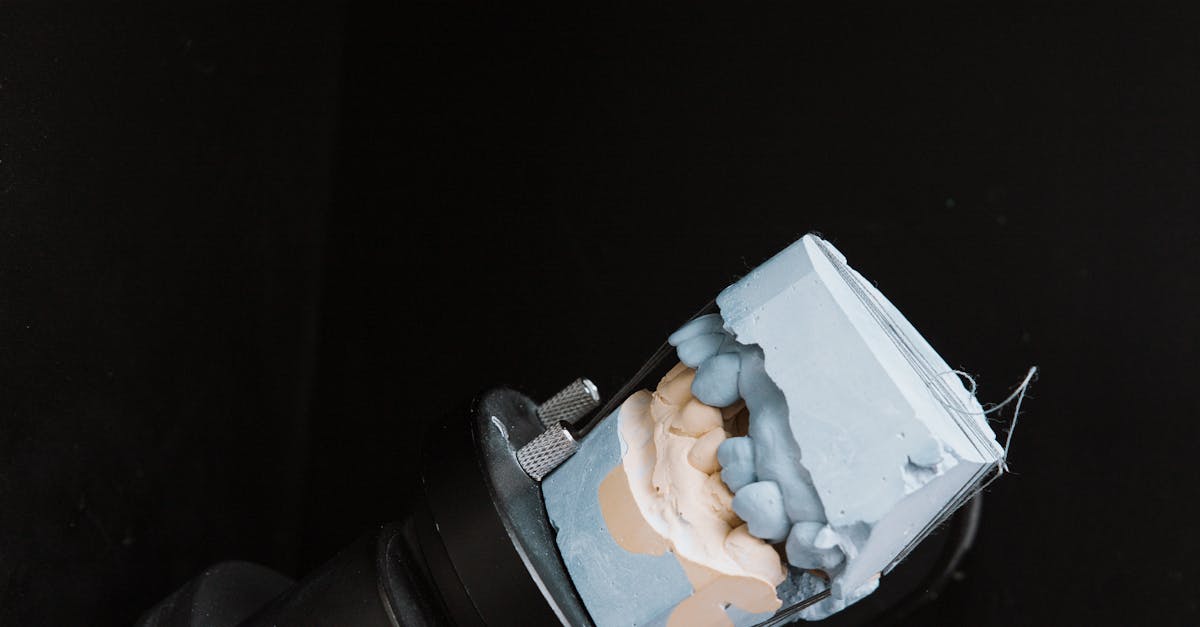 Evaluating the Importance of Soft Tissue Management in Implant Surgery
