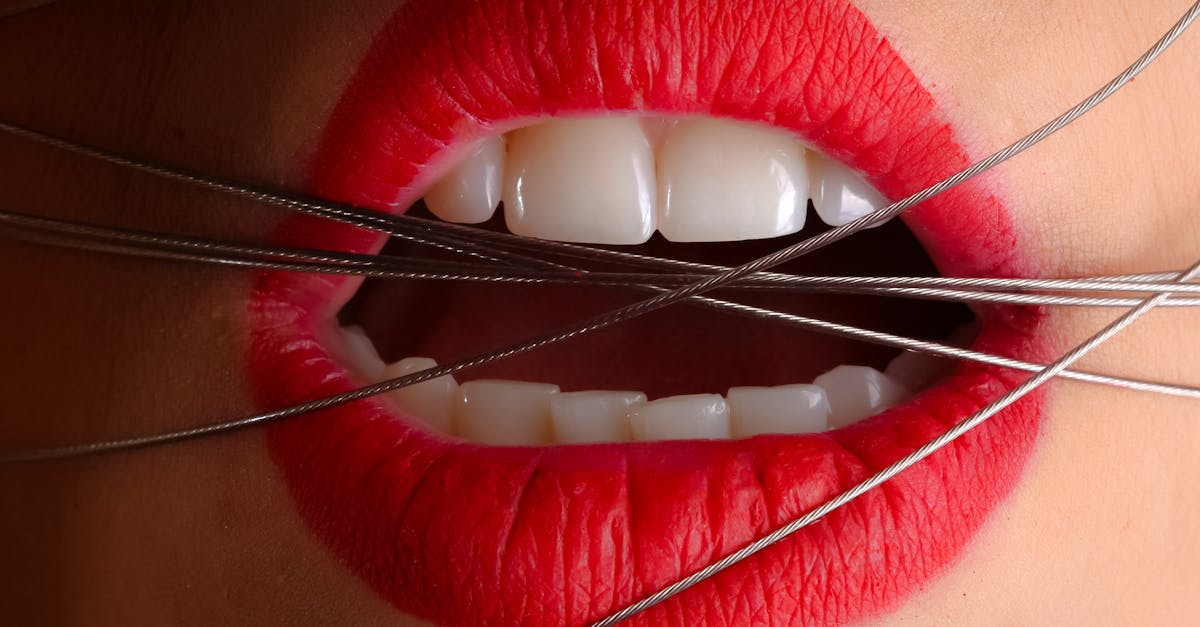 Exploring Conscious Sedation for Dental Implant Surgery