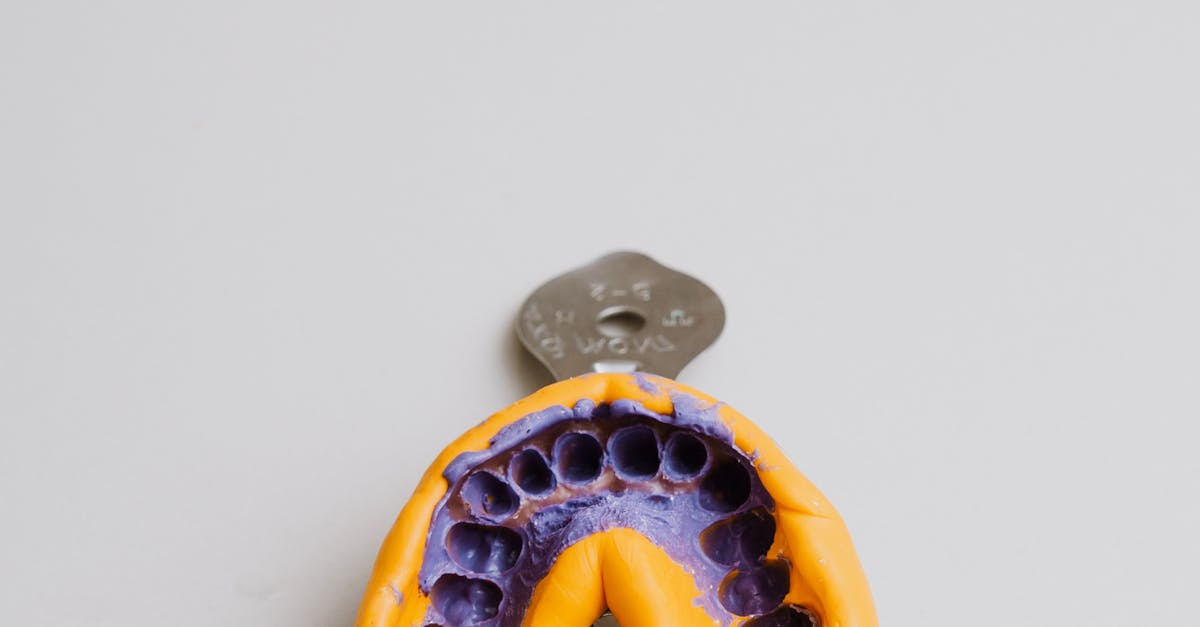 How Often Should You See Your Dentist After Getting Implants