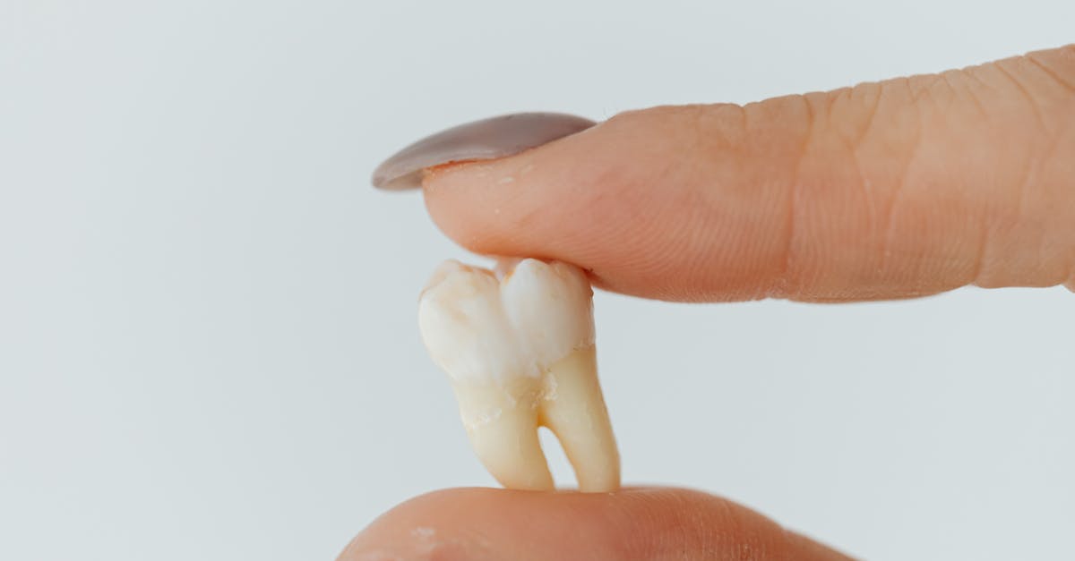 How to Prepare for Immediate Loading of Dental Implants