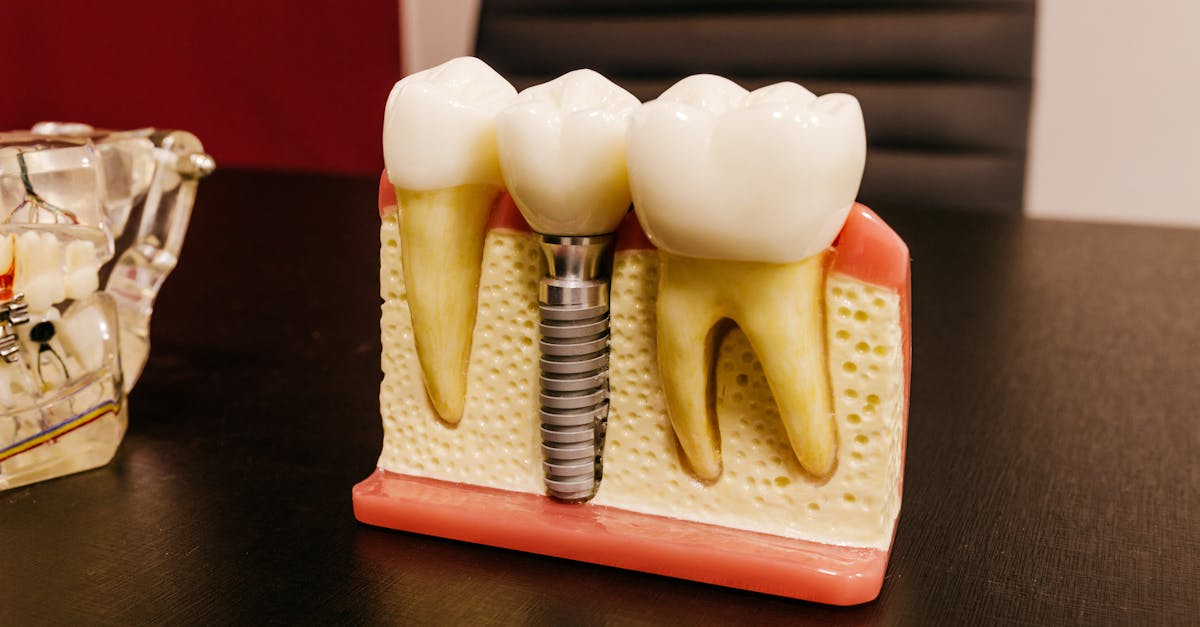 How to Prepare for the Pre-operative Assessment Appointment