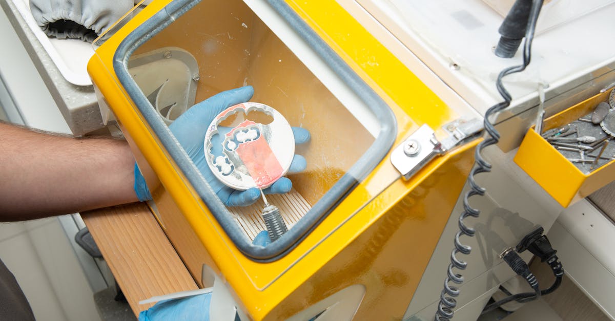 How Your Oral Health Affects the Dental Implant Recovery Timeline