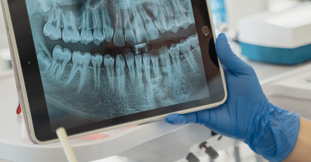 Identifying Common Complications After Implant Procedures