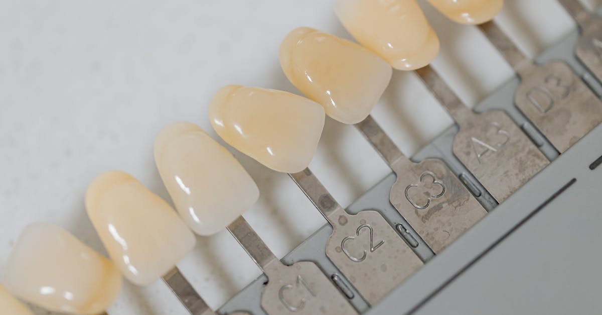 Key Aftercare Practices to Enhance Implant Longevity