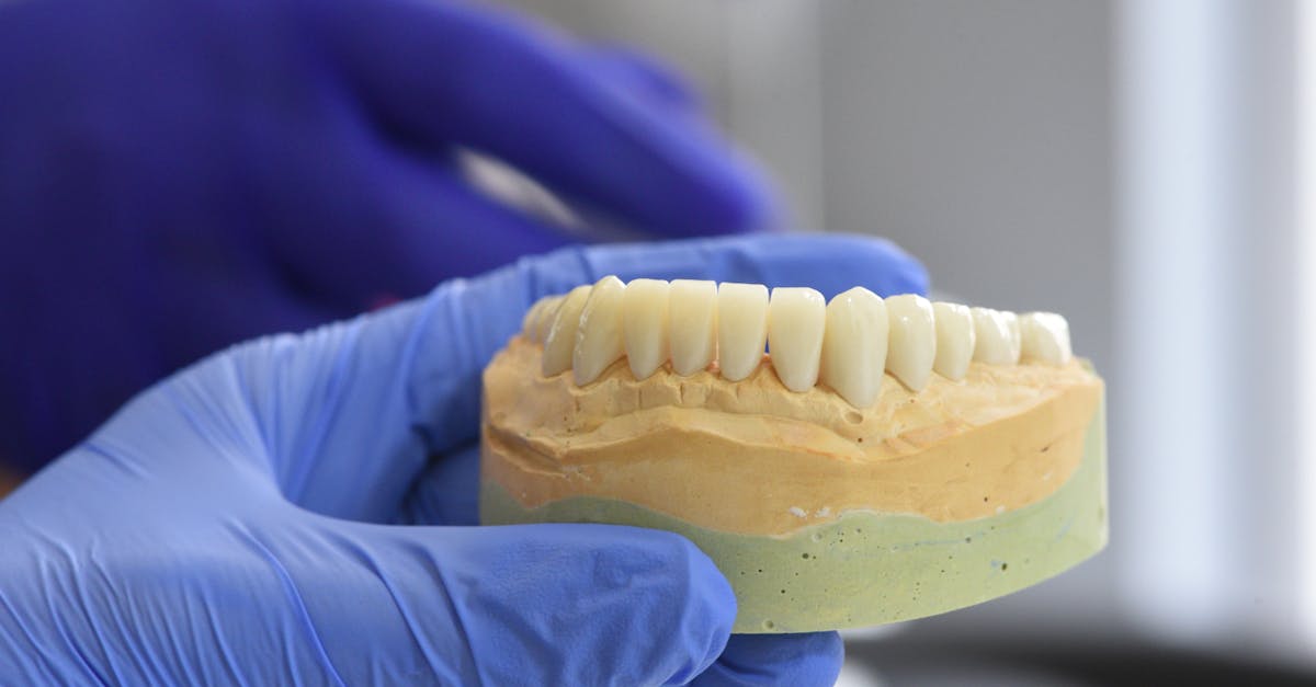 Key Milestones in the Recovery Journey After Dental Implant Surgery