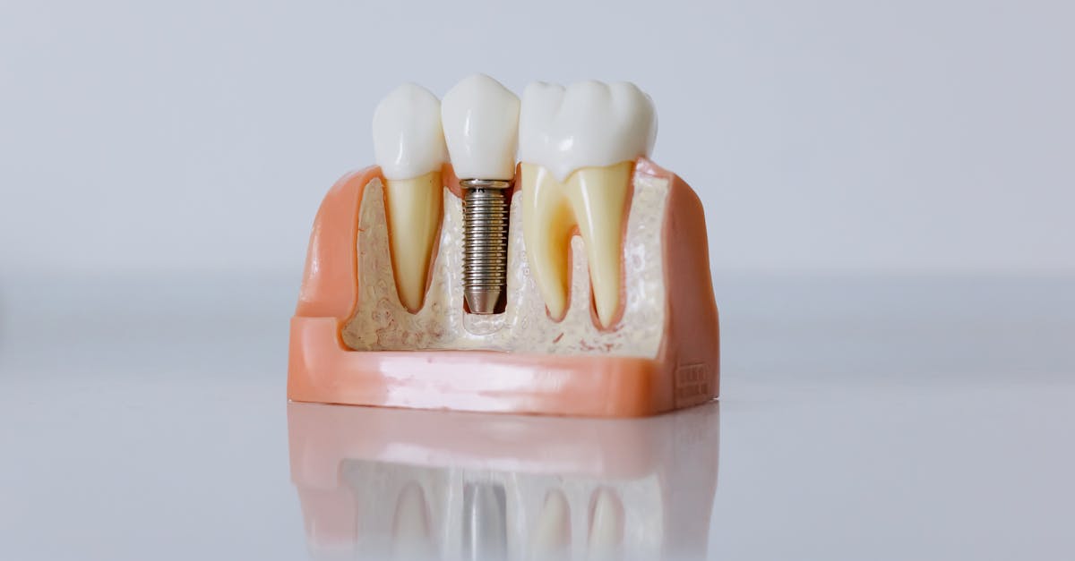 Nutritional Tips for Post-Implant Recovery in Brisbane