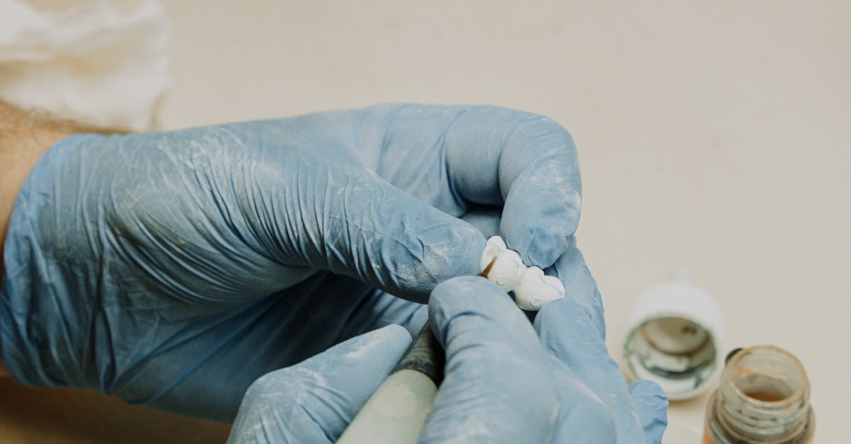 Recovery Expectations After Zygomatic Implant Placement