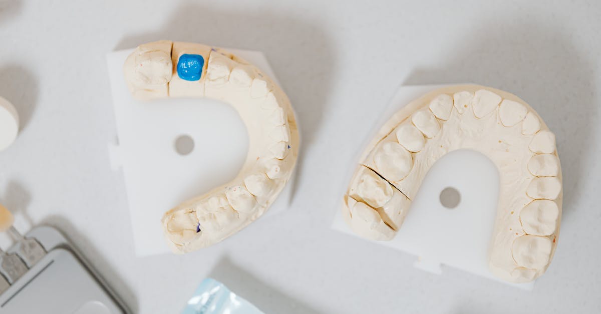 The Benefits of Minimally Invasive Implant Surgery Techniques