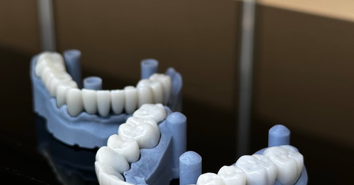 The Healing Process: Delayed Loading Considerations