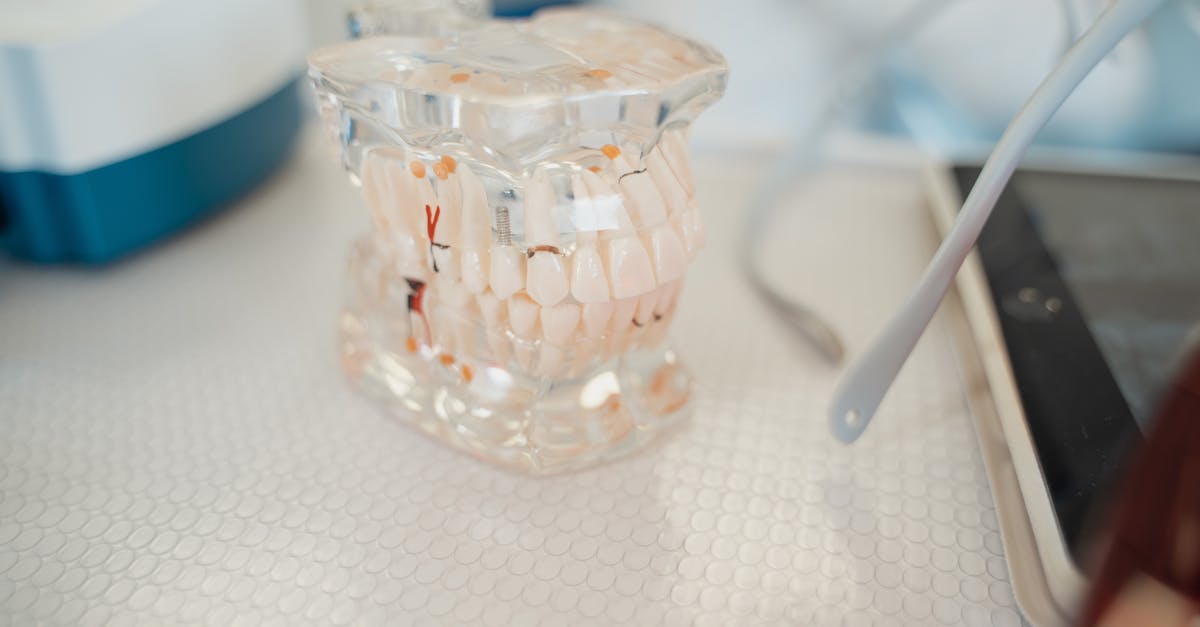 The Role of Bone Quality in Implant-Supported Denture Placement