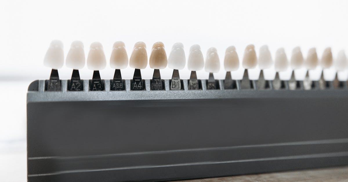 Tips for Managing Infection Risks Following Dental Implants