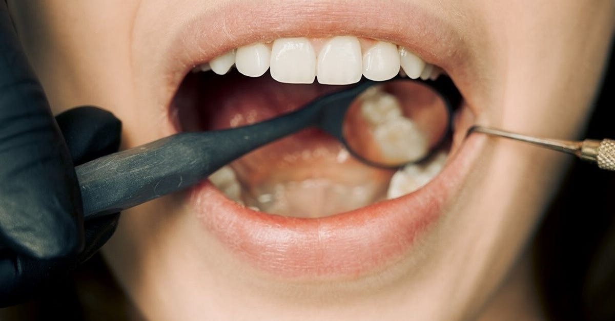 Understanding the Role of Comprehensive Assessments in Dental Implant Success